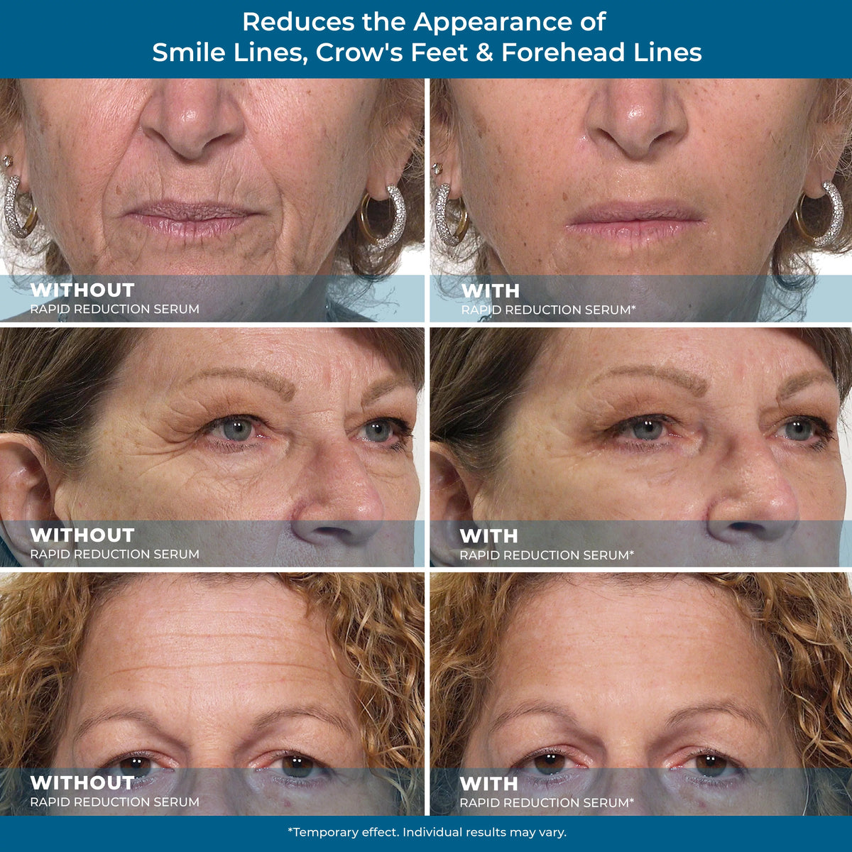 Rapid Reduction Eye Serum X359